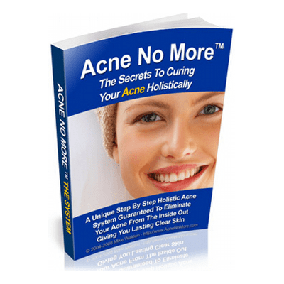 Effective acne removal remedies at home